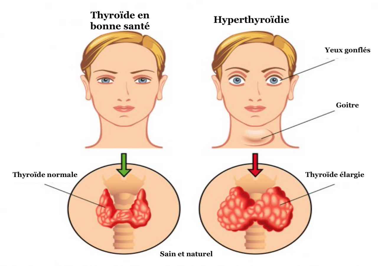 Test thyroïdien : maintenant vous pouvez savoir si votre thyroïde fonctionne bien